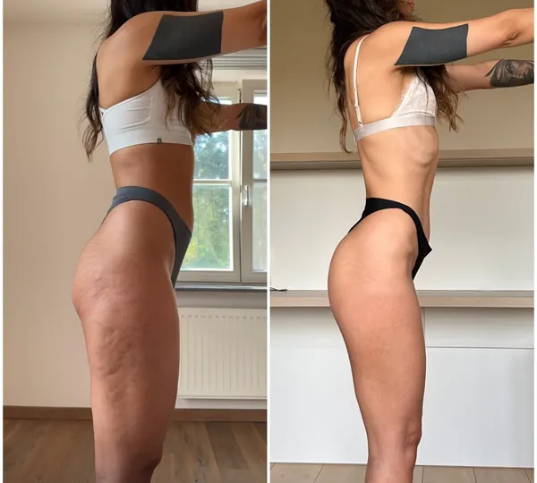 Antes y después, lado a lado: aprender a comer y sentirse acompañada.