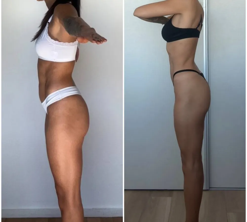 Antes y después: más firmeza en abdomen y glúteos.