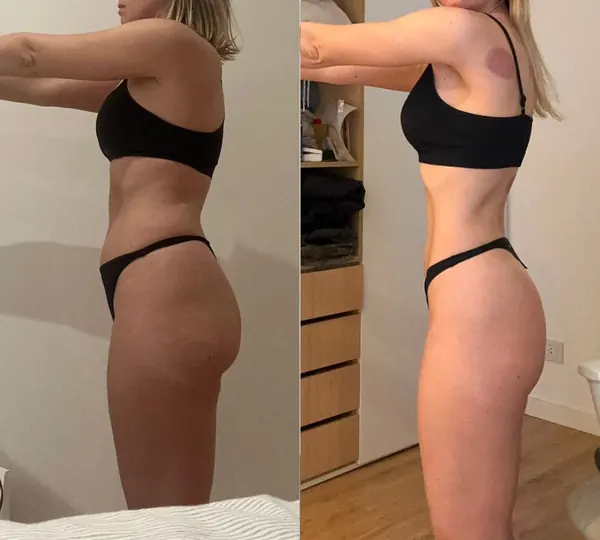 Antes y después, lado a lado: un abdomen más plano y un cuerpo más firme.