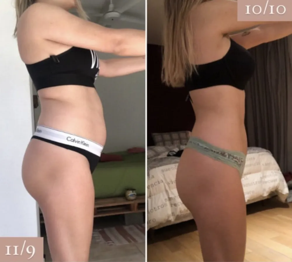 Antes y después, de perfil: abdomen más plano y cintura más marcada.